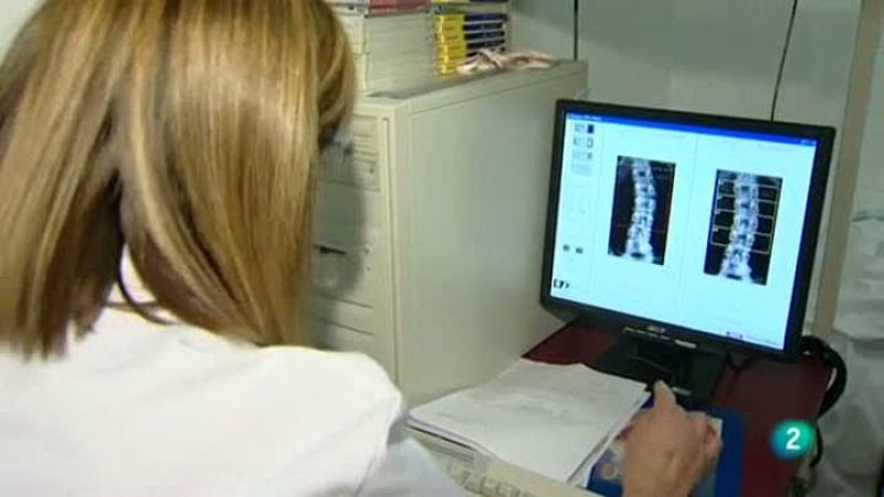 Para todos La 2 - Debate - La osteoporosis