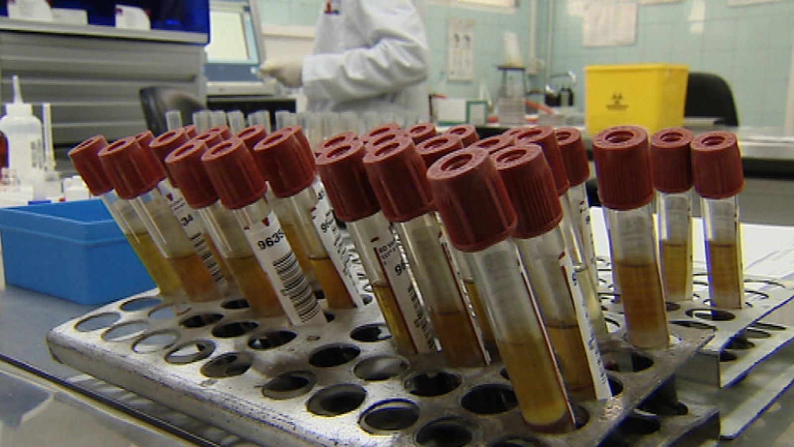 El uso del preservativo sigue siendo fundamental para evitar las enfermedades sexuales