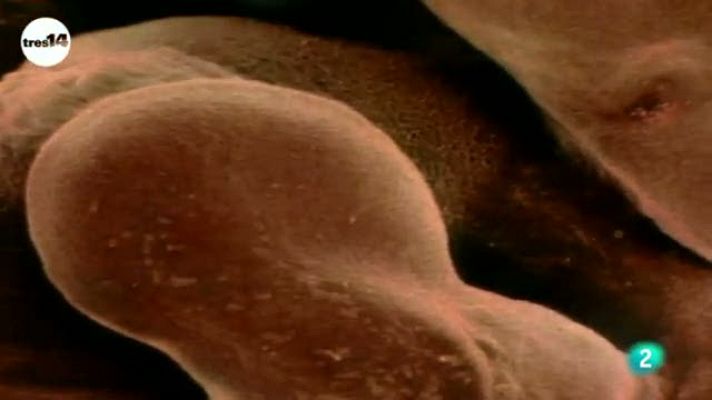 tres14 - Los bebés tienen más huesos