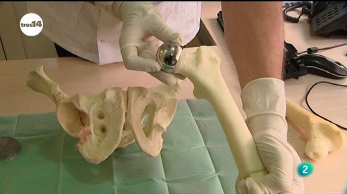 tres14 - Nuevos Huesos