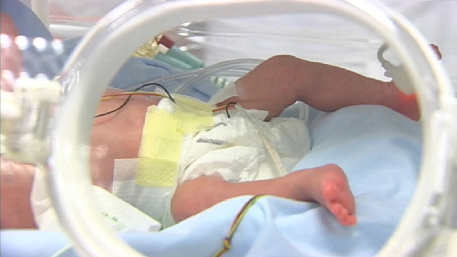 Los recortes en sanidad de Castilla La Mancha reducen los diagnósticos precoces en bebés