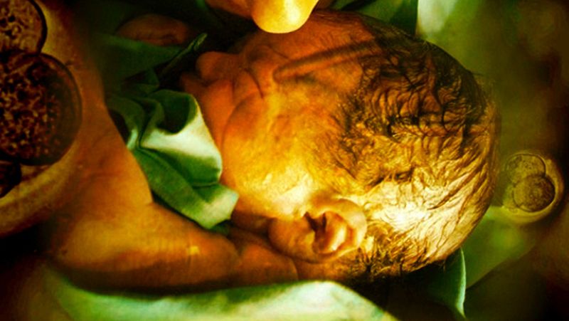  La Noche Temática - Células madre, una nueva esperanza - Avance