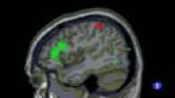 Telediario 1 - Mecanismo que favocere la memoria