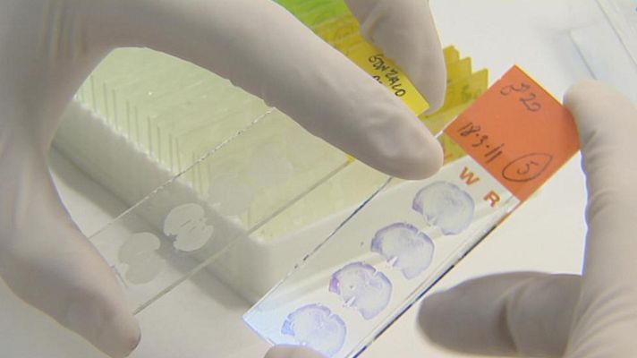 Telediario 1 - Mecanismo que favocere la memoria