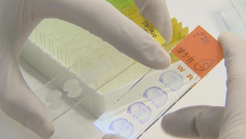 Un tipo de molécula, introducida en el cerebro de ratas, mejora sus conexiones neuronales