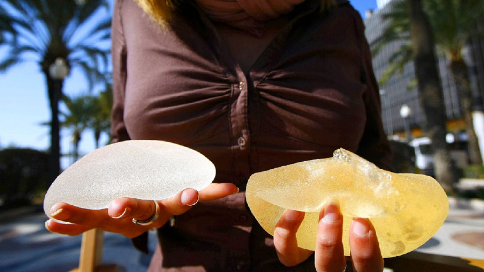 Detienen al fabricante de implantes mamarios PIP, imputado por lesiones y homicidios involuntarios