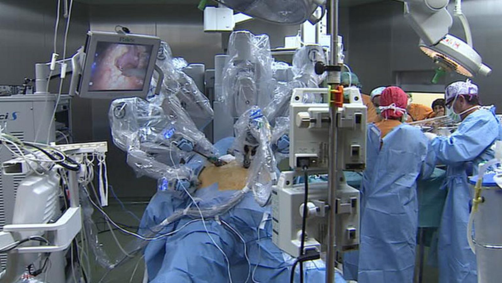 Operados a 3 adolescentes que sufrían obesidad mórbida con un robot