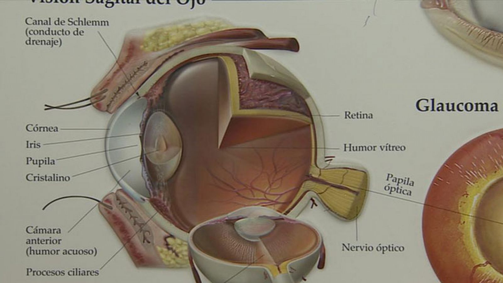 Telediario 1: El desconocimiento de la glaucoma | RTVE Play