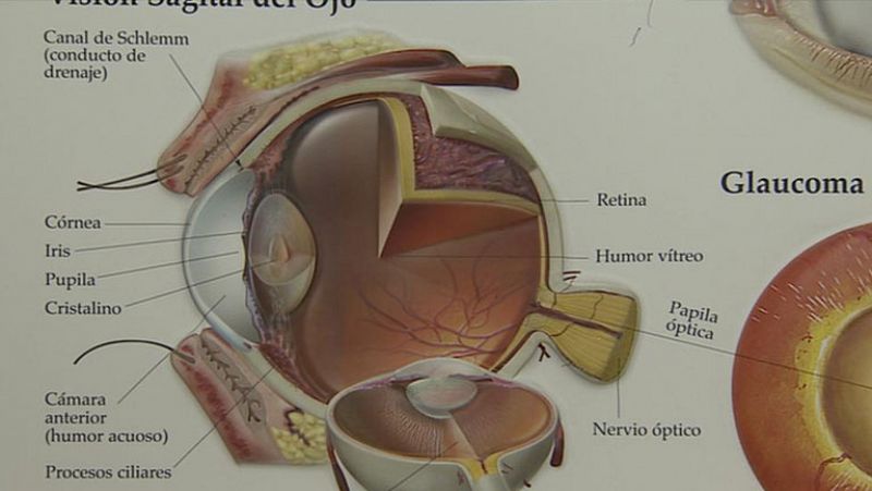 Casi un millón de personas en España sufre glaucoma 