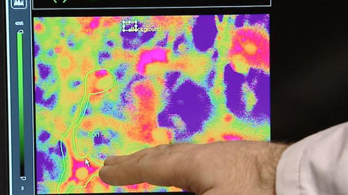 Telediario 1 - Ansiedad y medicamentos