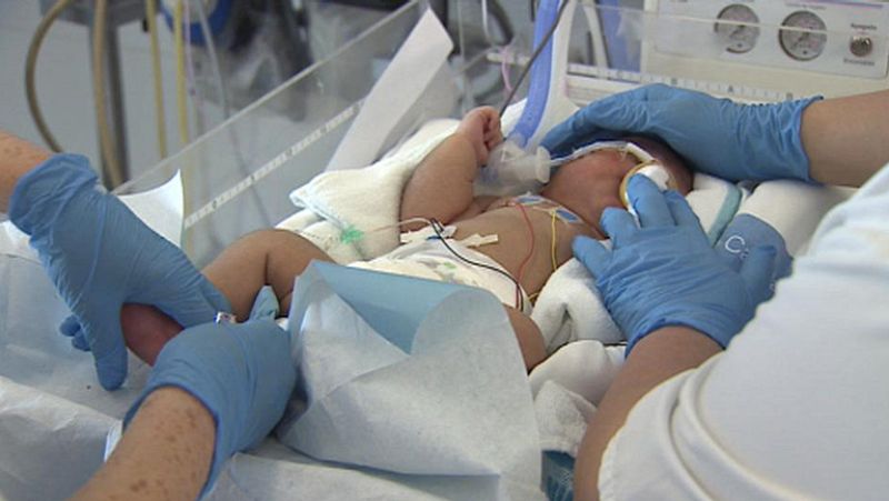 Un simple anillo de silicona podría evitar el 75% de los partos prematuros