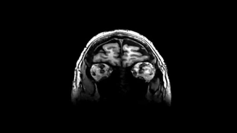 Somos como somos por un error genético