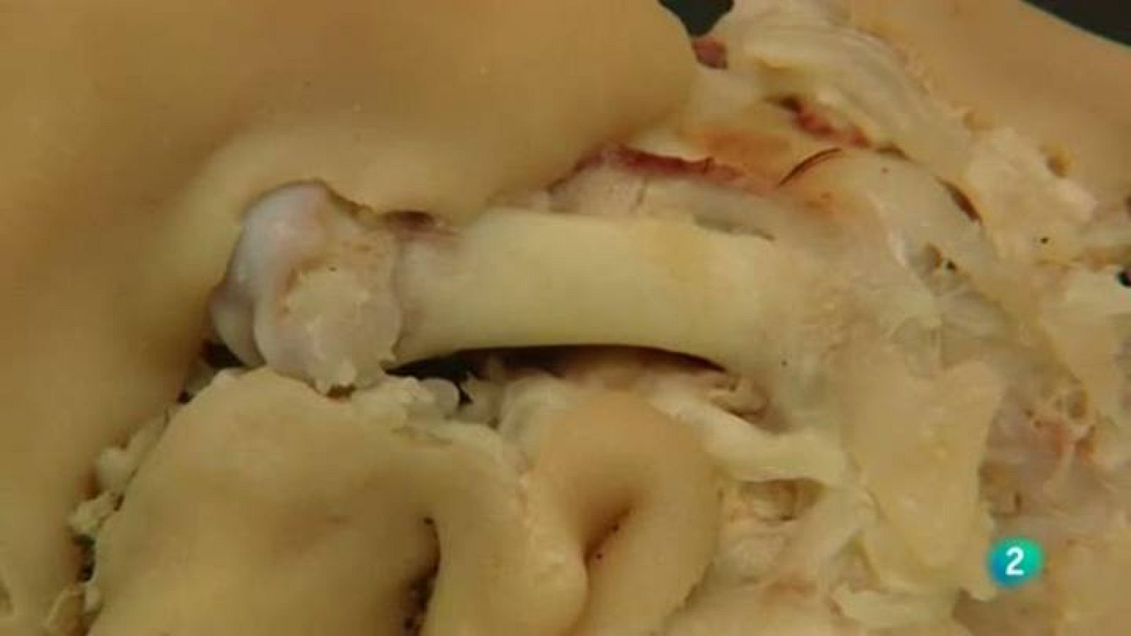 Para Todos La 2 - Nutrición: ¿són buenos para la salud los pies de cerdo?