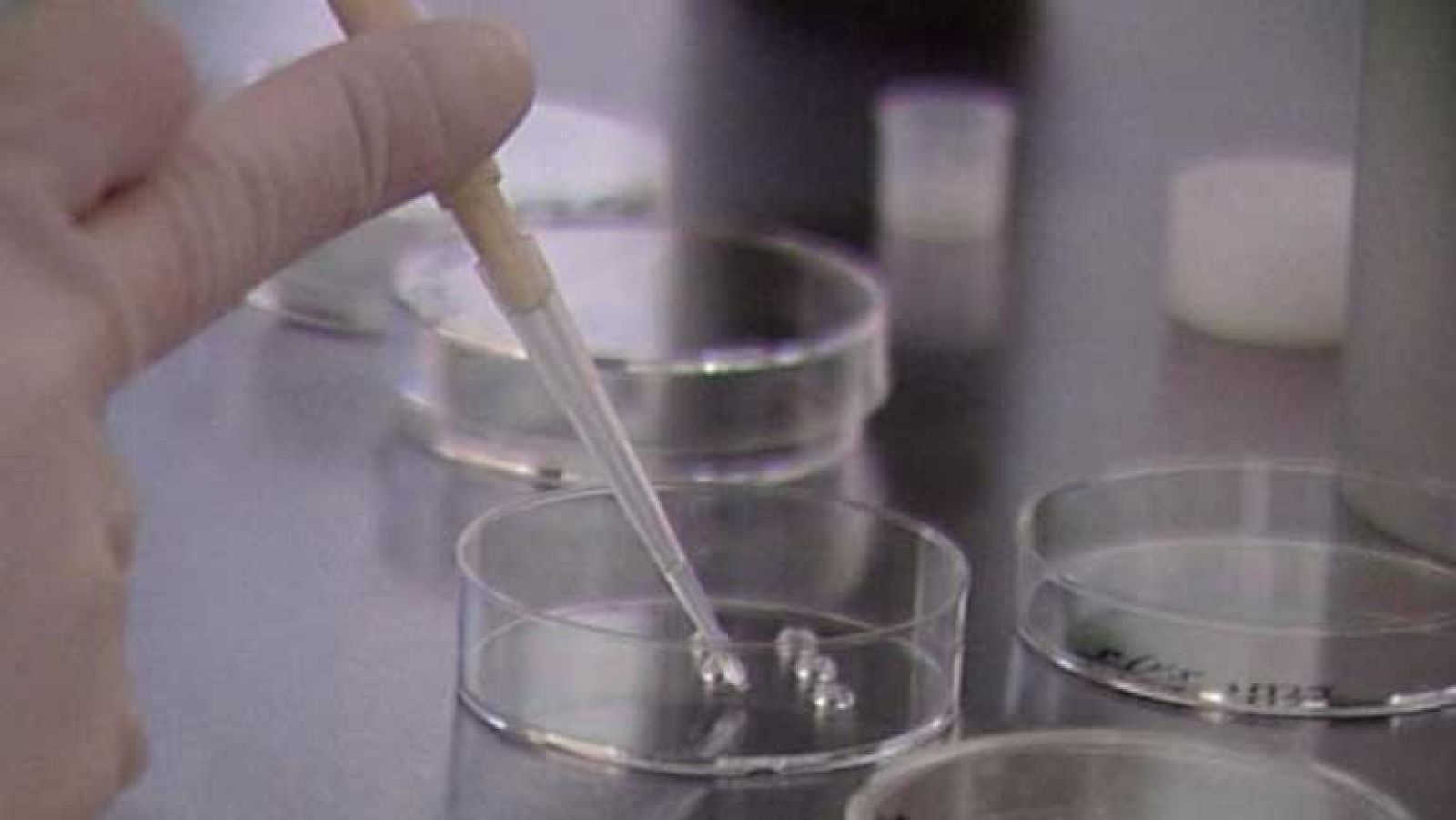 Uso de células madre para la reconstrucción de mamas