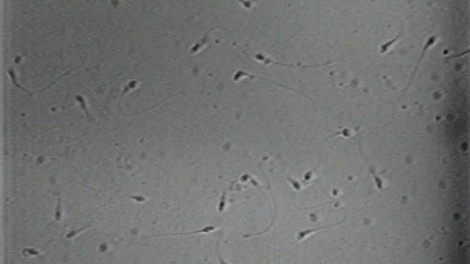 Las donaciones de semen aumentan con la crisis