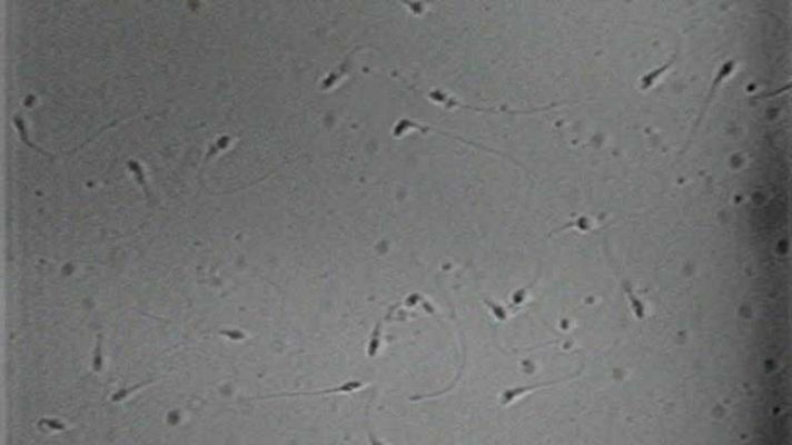 Telediario 1 - Aumentan las donaciones de semen