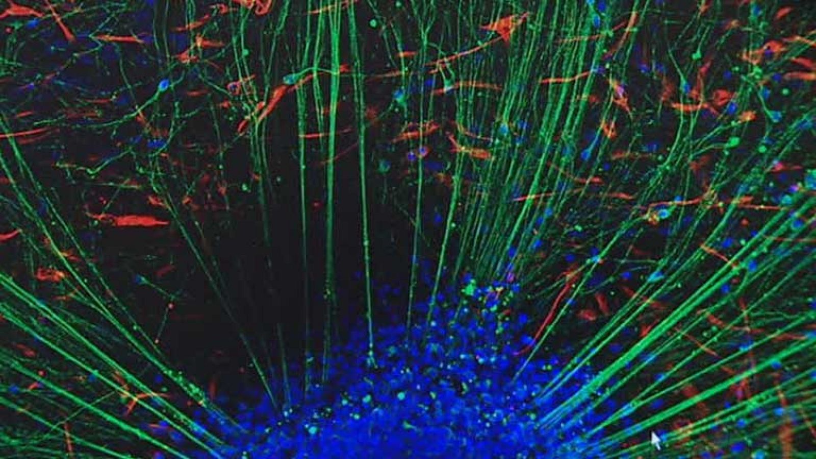 Investigadores logran convertir células de sangre del cordón umbilical en neuronas