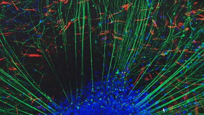 Investigadores logran convertir células de sangre del cordón umbilical en neuronas