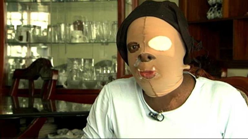 Manifestación en Colombia para que se endurezca la pena por atacar con ácido a mujeres