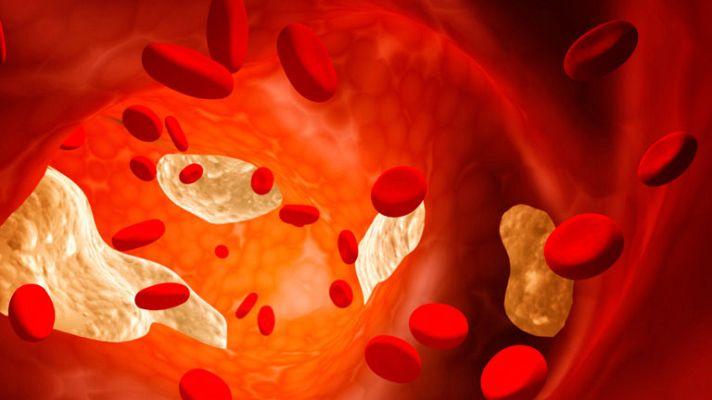 La mañana - Sobrepeso + sedentarismo = peligro