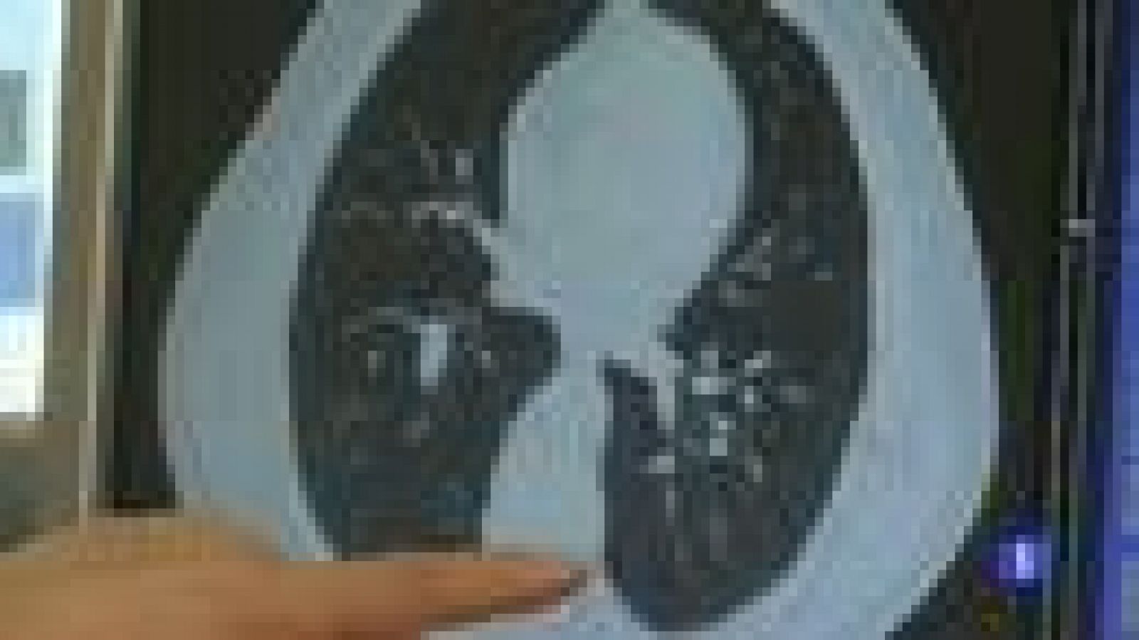 Telediario 1: Más canceres de pulmón  | RTVE Play