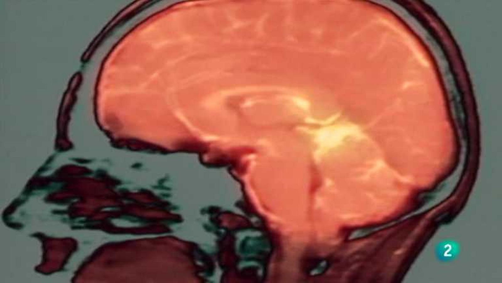 La noche temática - La plasticidad del cerebro - Ver ahora