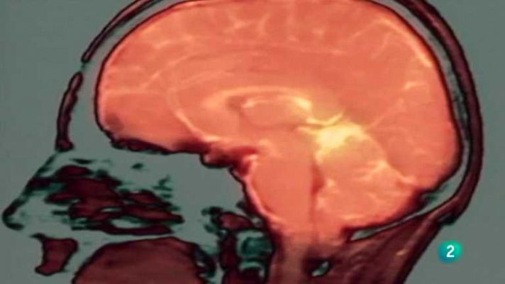 La noche temática - La plasticidad del cerebro