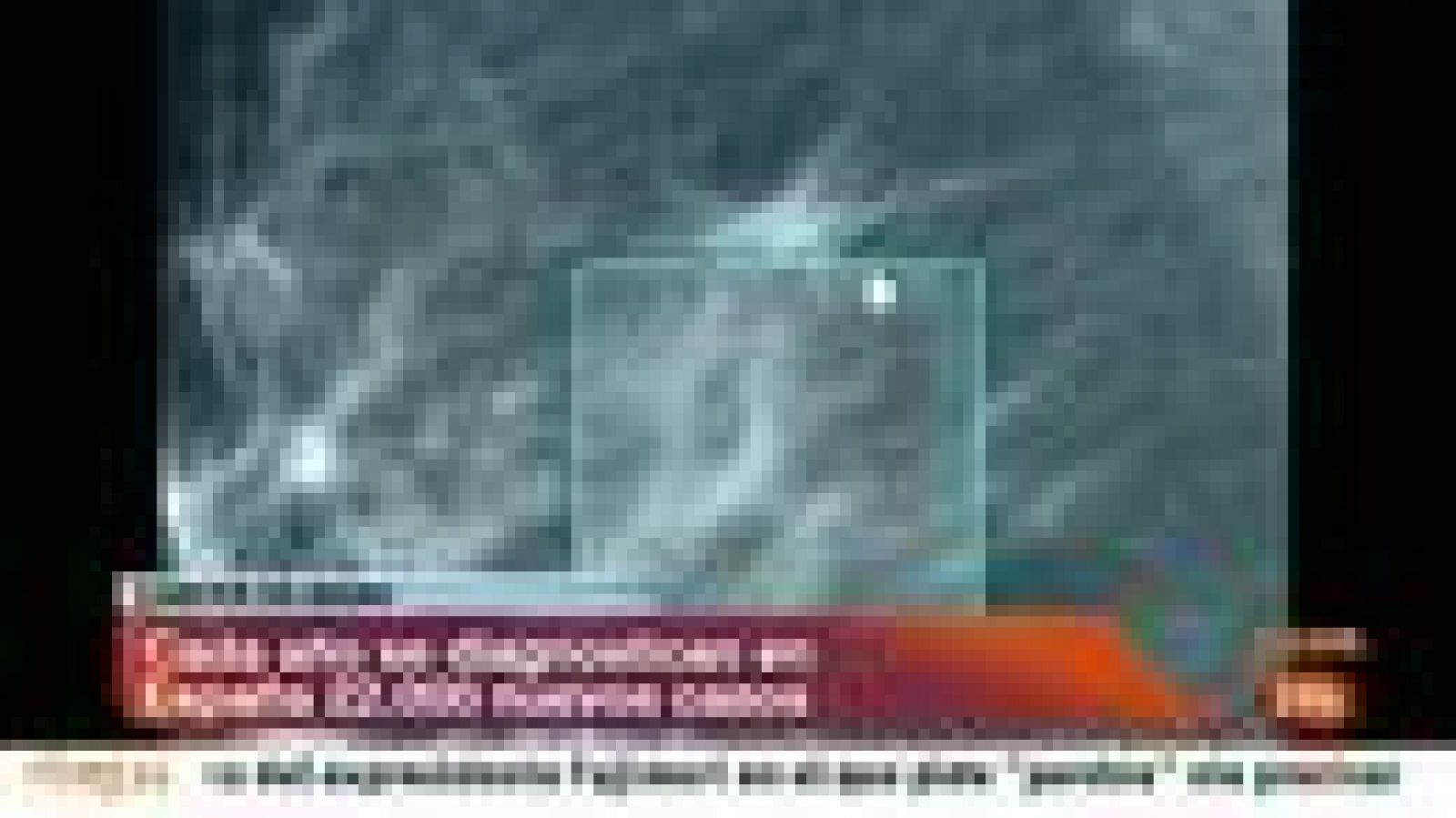 El índice de supervivencia de las mujeres que padecen cáncer de mama es del 85% - Informativo 24h | Ver