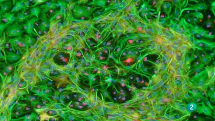 Talento 100 - Capítulo 2