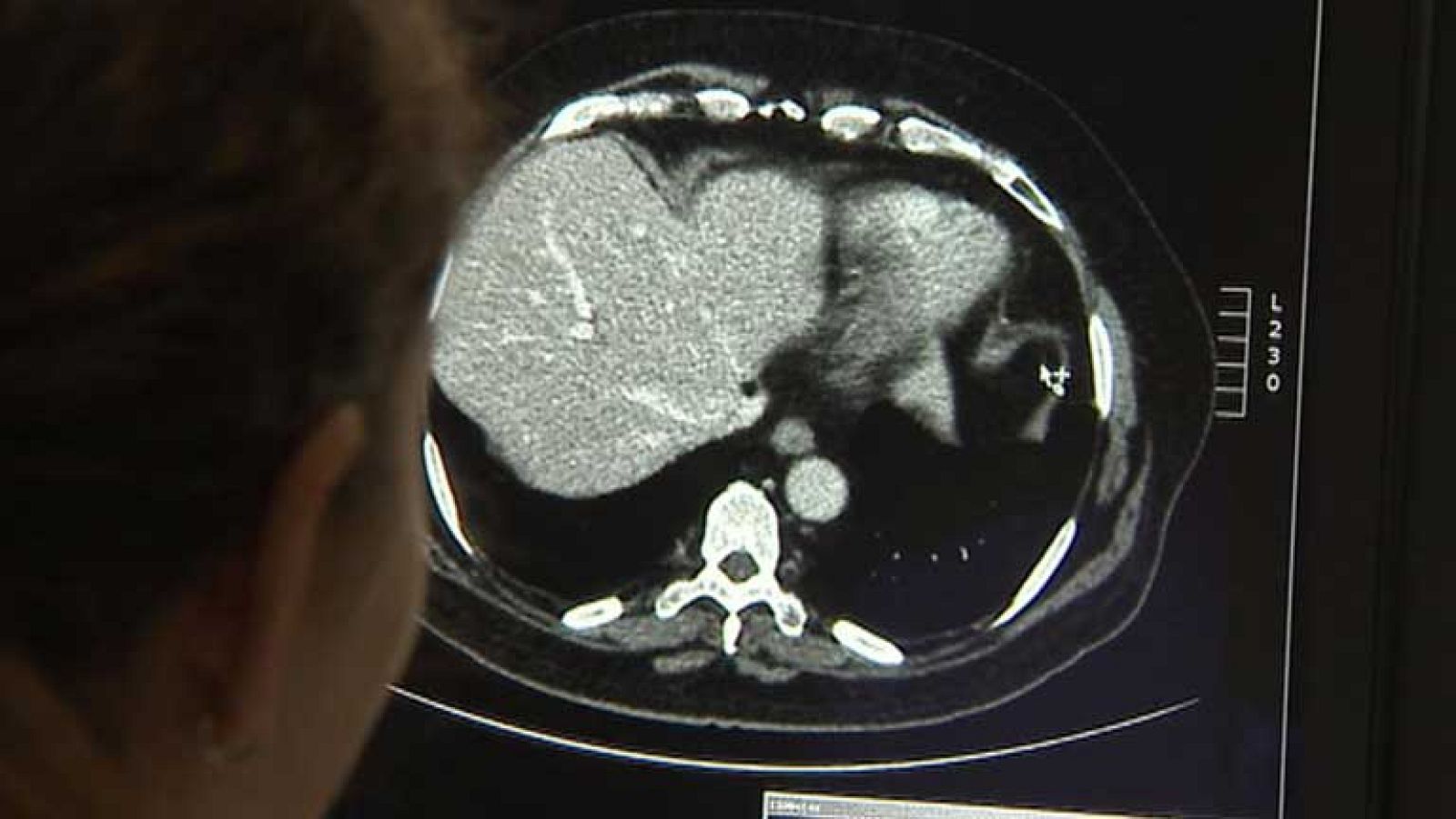 Día internacional de la radiología