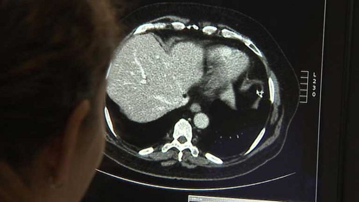 Telediario 1 - Día internacional de la radiología