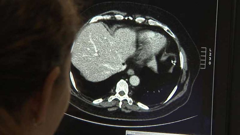 Día internacional de la radiología