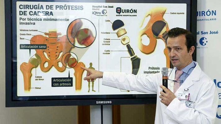 Telediario 1 - Telediario 1 en 4' - 24/11/12