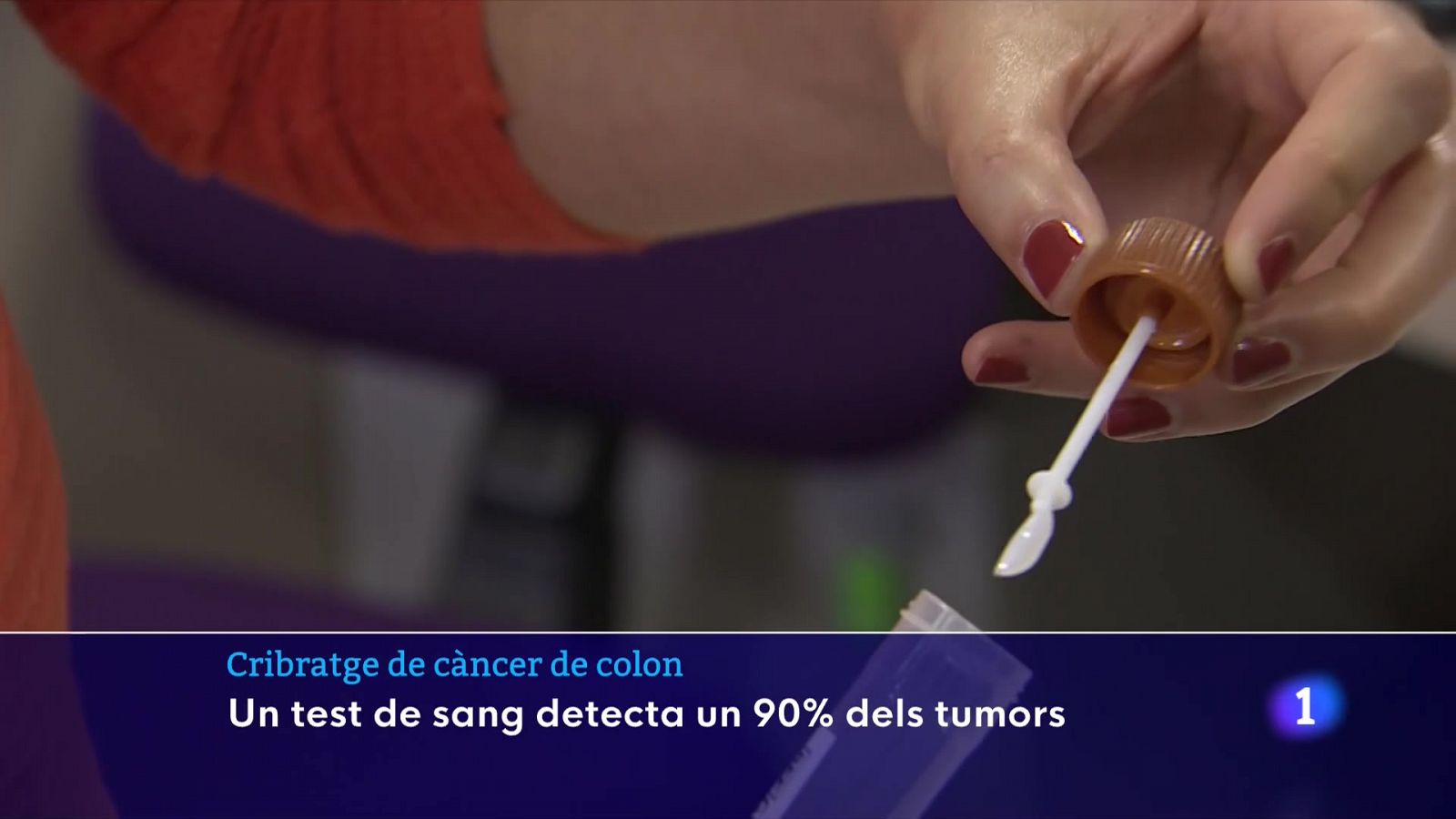Un test de sang detecta un 90% dels tumors de còlon i recte - L'Informatiu | Ver