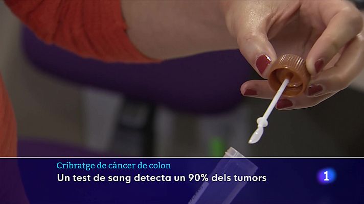 Un test de sang detecta un 90% dels tumors de còlon i recte