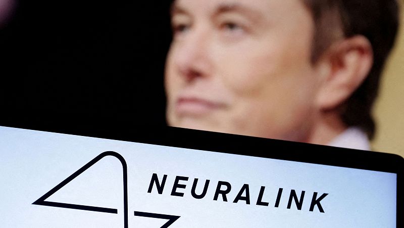 Musk anuncia el primer implante de un chip en el cerebro de un ser humano y lo llama "telepatía"