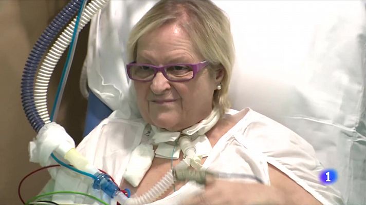 L'Informatiu - Respirar gràcies a una màquina: la rehabilitació amb ECMO millora la supervivència
