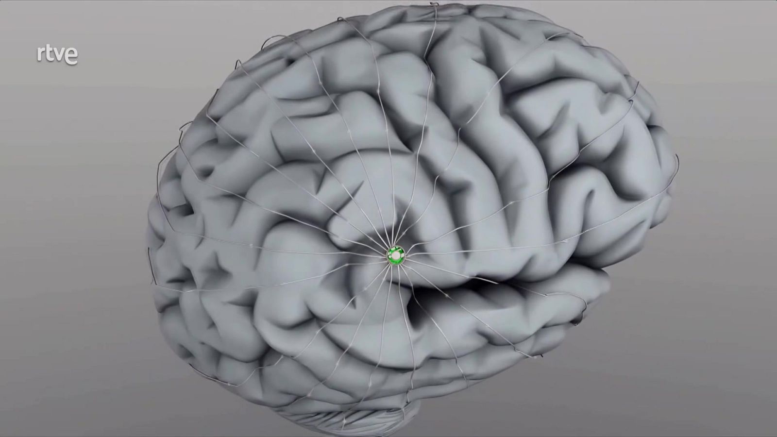 Resumen del 17/02/2024 | Ver