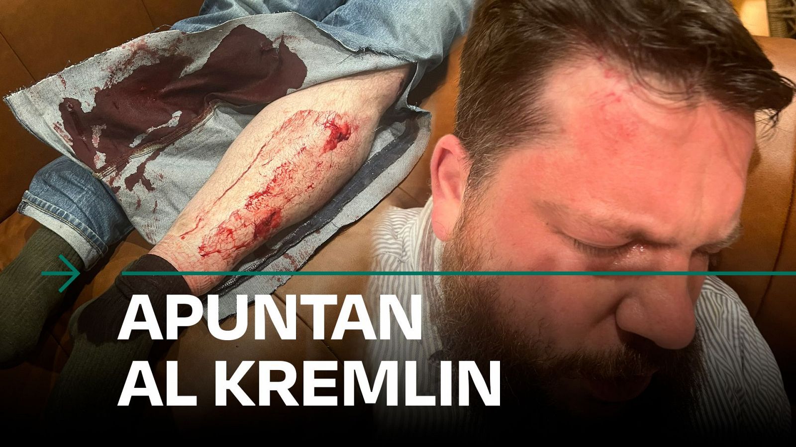 Atacan con 15 martillazos a un exasesor de Navalni