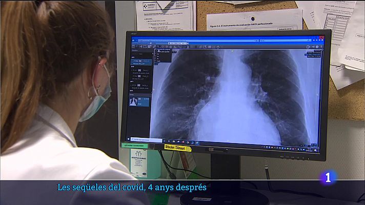 Informatiu Balear - Informatiu Balear 1 - 14/03/24