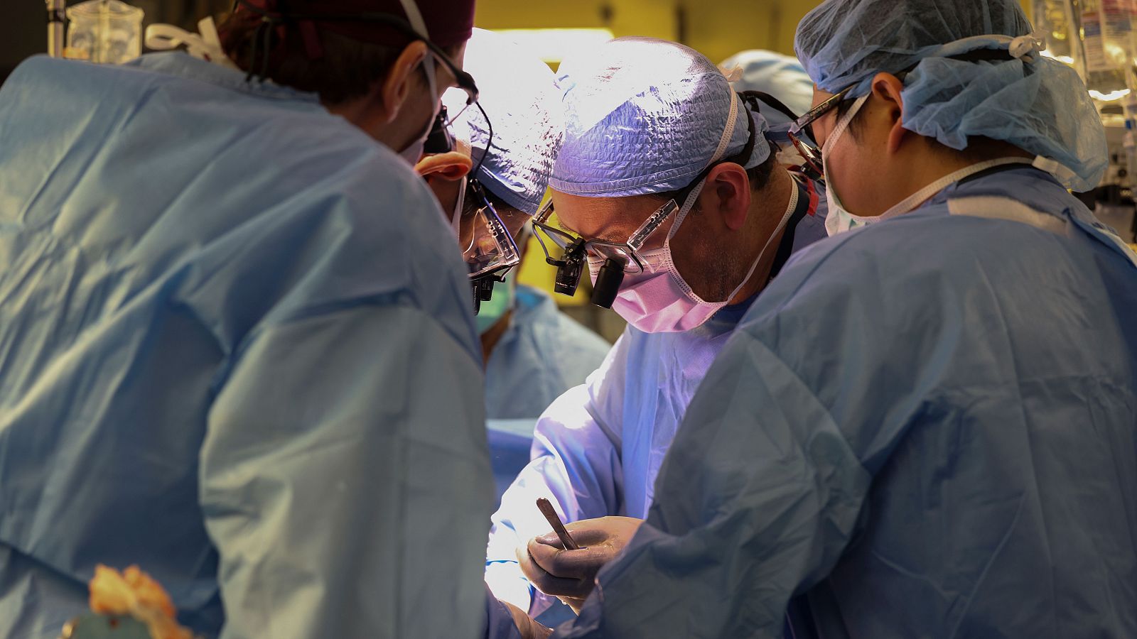 Cirujanos de Estados Unidos trasplantan por primera vez un riñón de cerdo a un paciente vivo