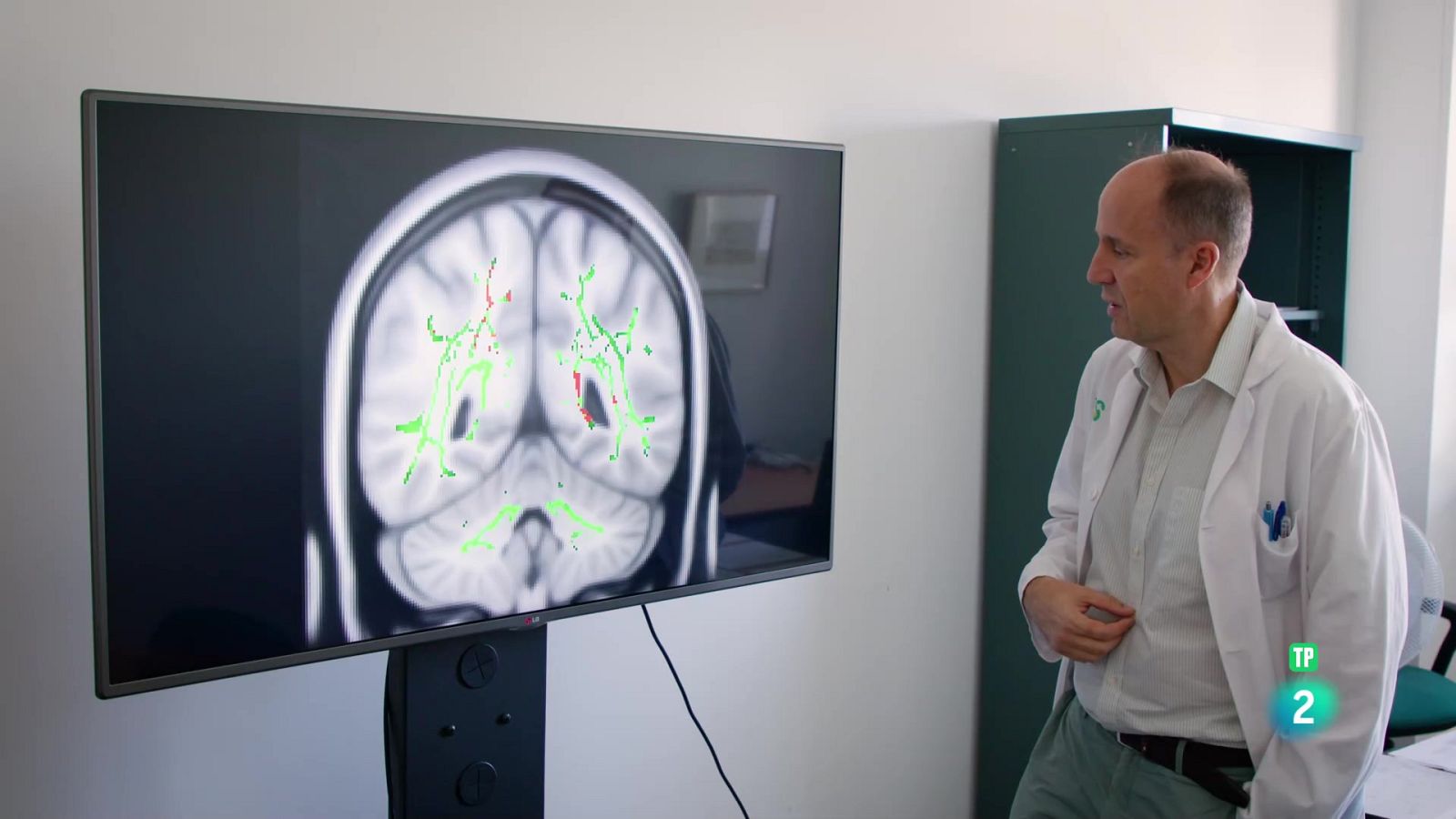 Universo Sostenible. Covid persistente | Ver