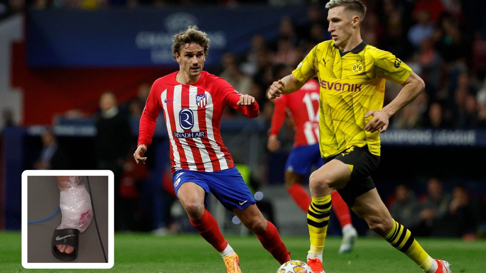 Griezmann acabó con el tobillo tocado tras jugar con el Dortmund - Champions League | Ver