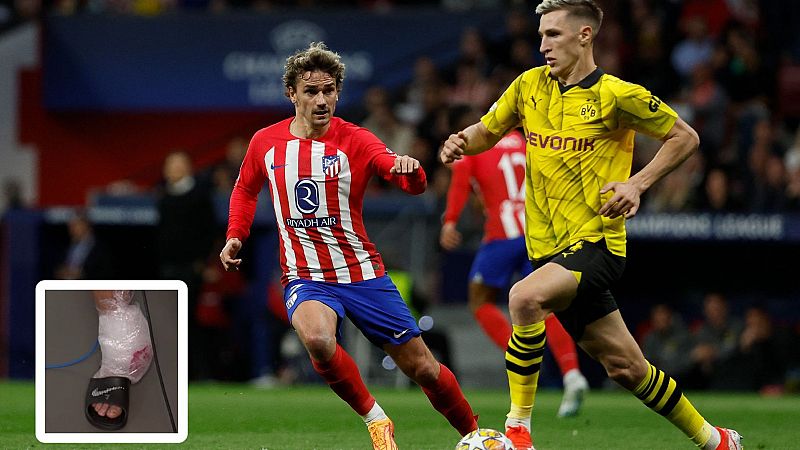 Griezmann acab con el tobillo tocado tras jugar los 90 minutos contra el Dortmund