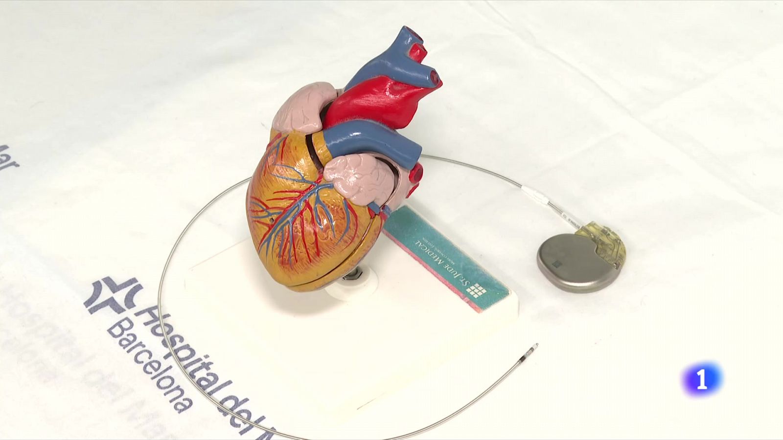 Canviar el punt d'estimulació del marcapassos dins del cor pot reduir complicacions - L'Informatiu | Veure