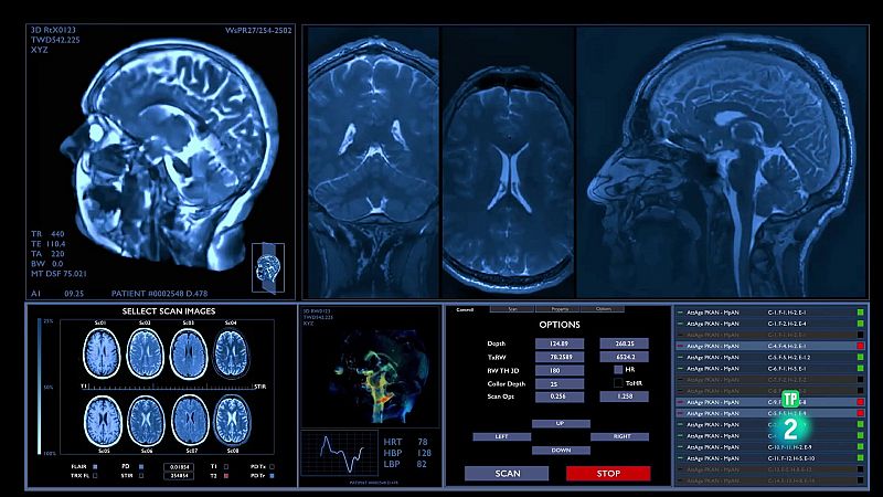 Universo Sostenible: Qué es la medicina de la complejidad | Ver