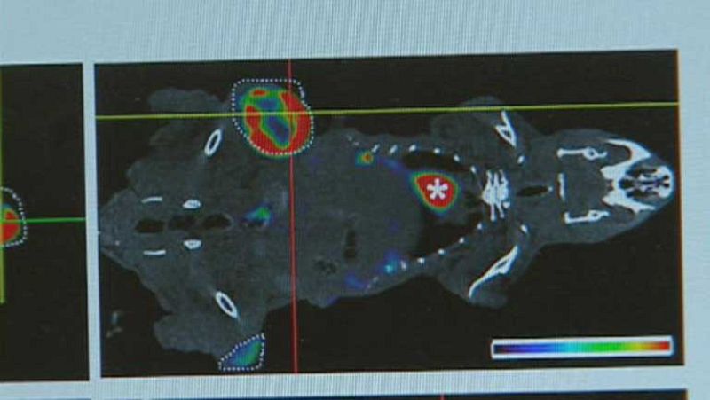 Científicos españoles descubren uno de los mecanismos que intervienen en la metástasis