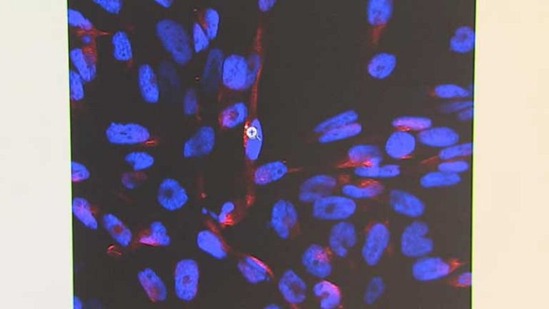 En el hospital del Vall d'Hebron descubren dos proteínas que producen metástasis