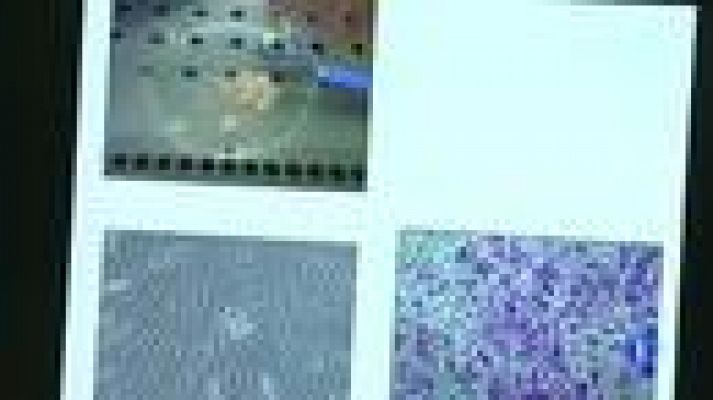 Telediario 1 - Cómo regenerar el cartílago dañado