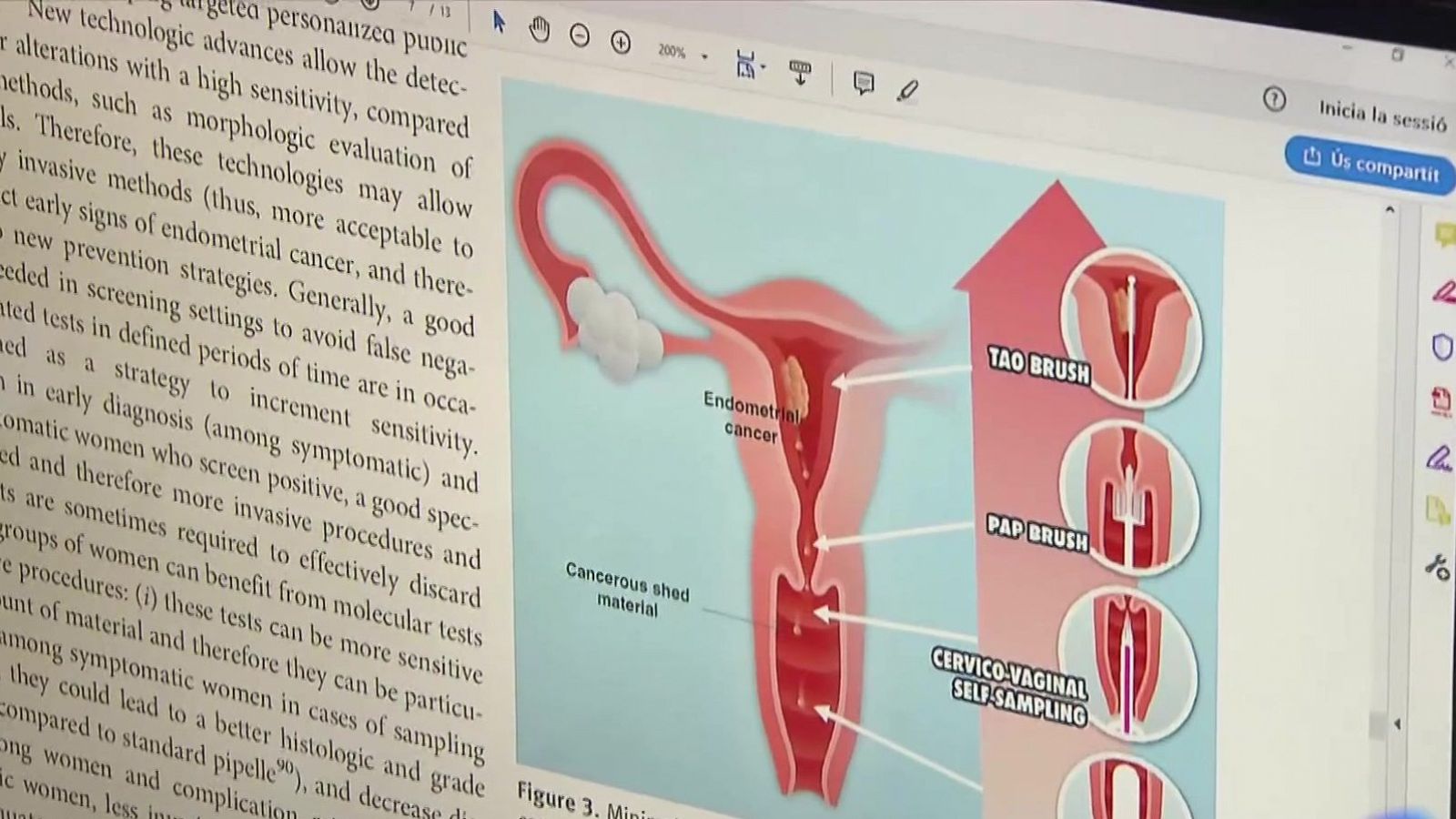 Només 149 baixes per menstruació incapacitant